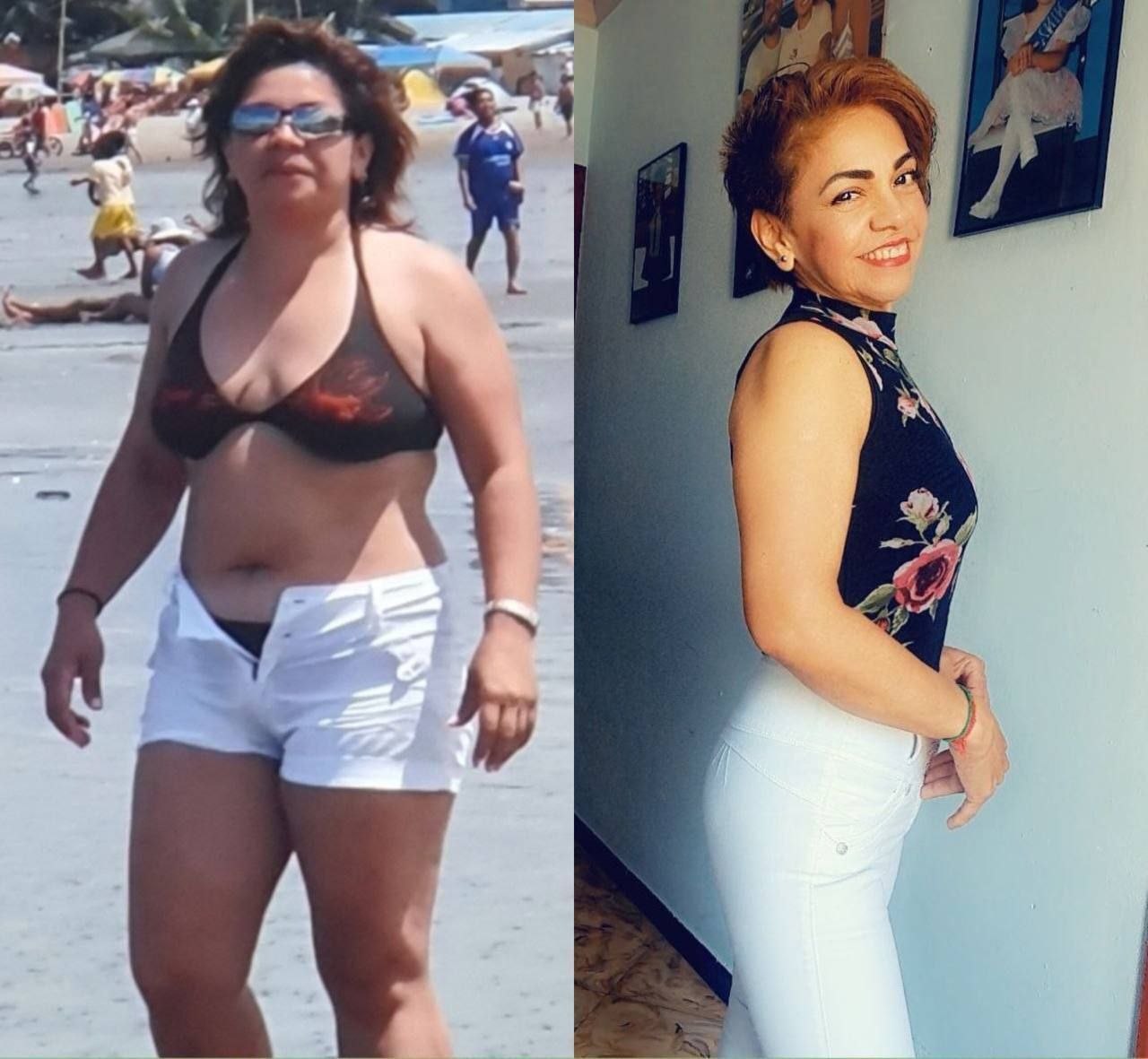 Teresa: Antes y Después — transformación real de más de 20 kg